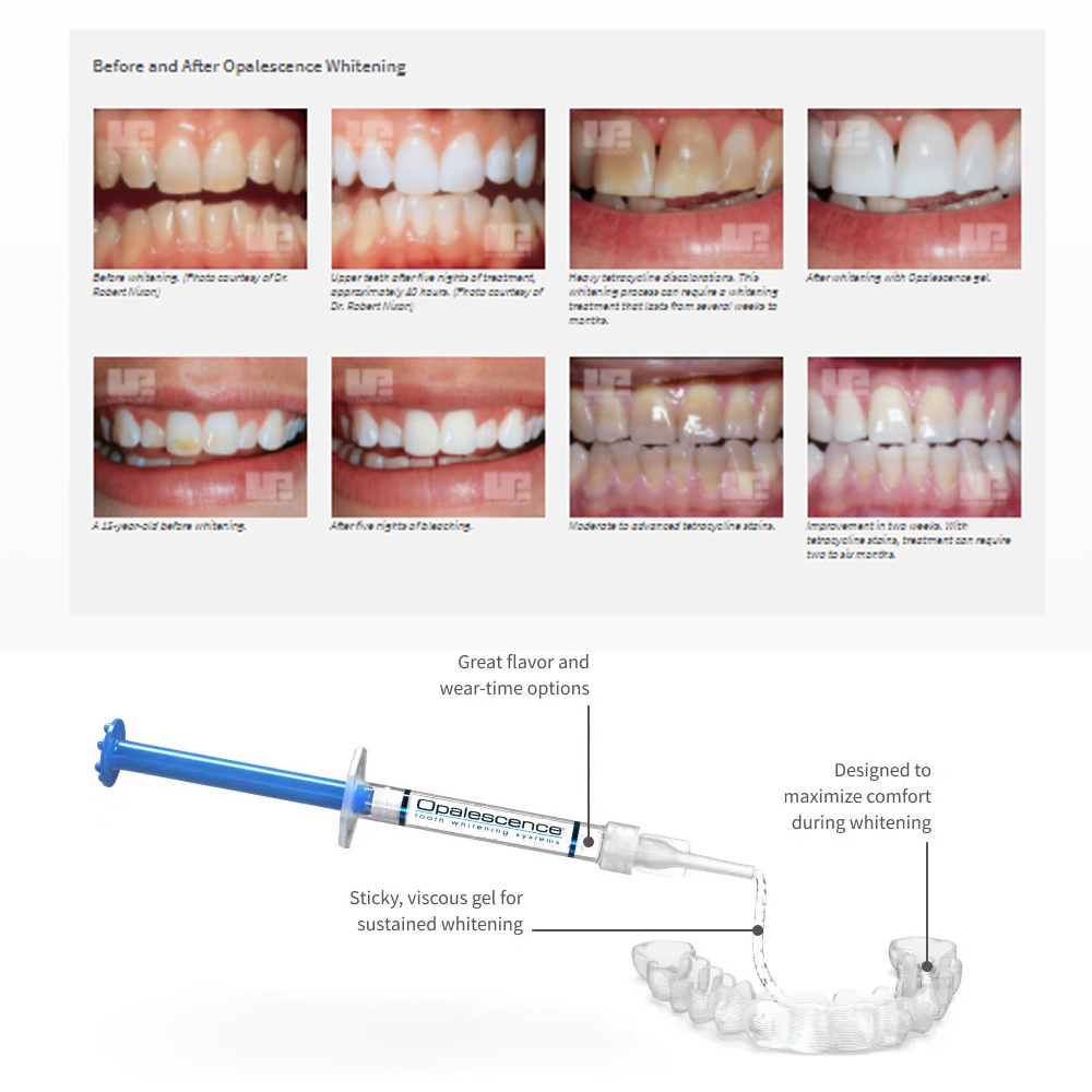 Opalescence Whitening 20% PF 2 - Teeth Whitening With Hydrogen Peroxide recension och pris