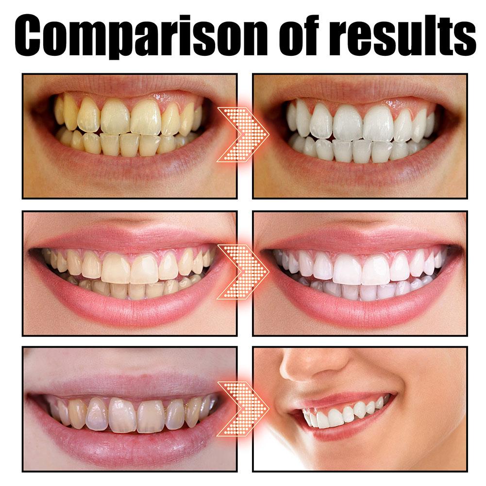 Coconut Mint Pulling Oil Mouth - Teeth Whitening With Coconut Oil recension och pris