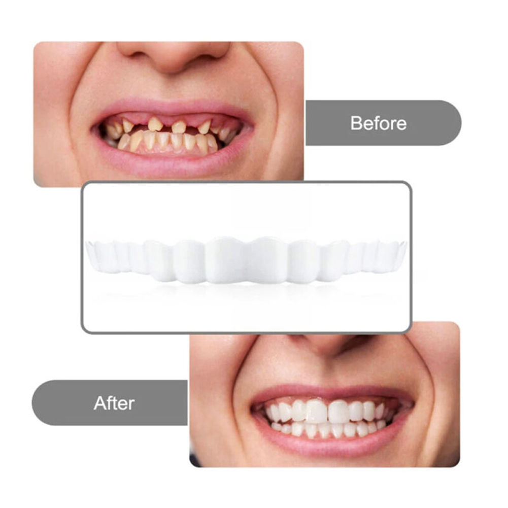 newSilicone Denture Set Fit Te - Teeth Whitening Usa recension och pris
