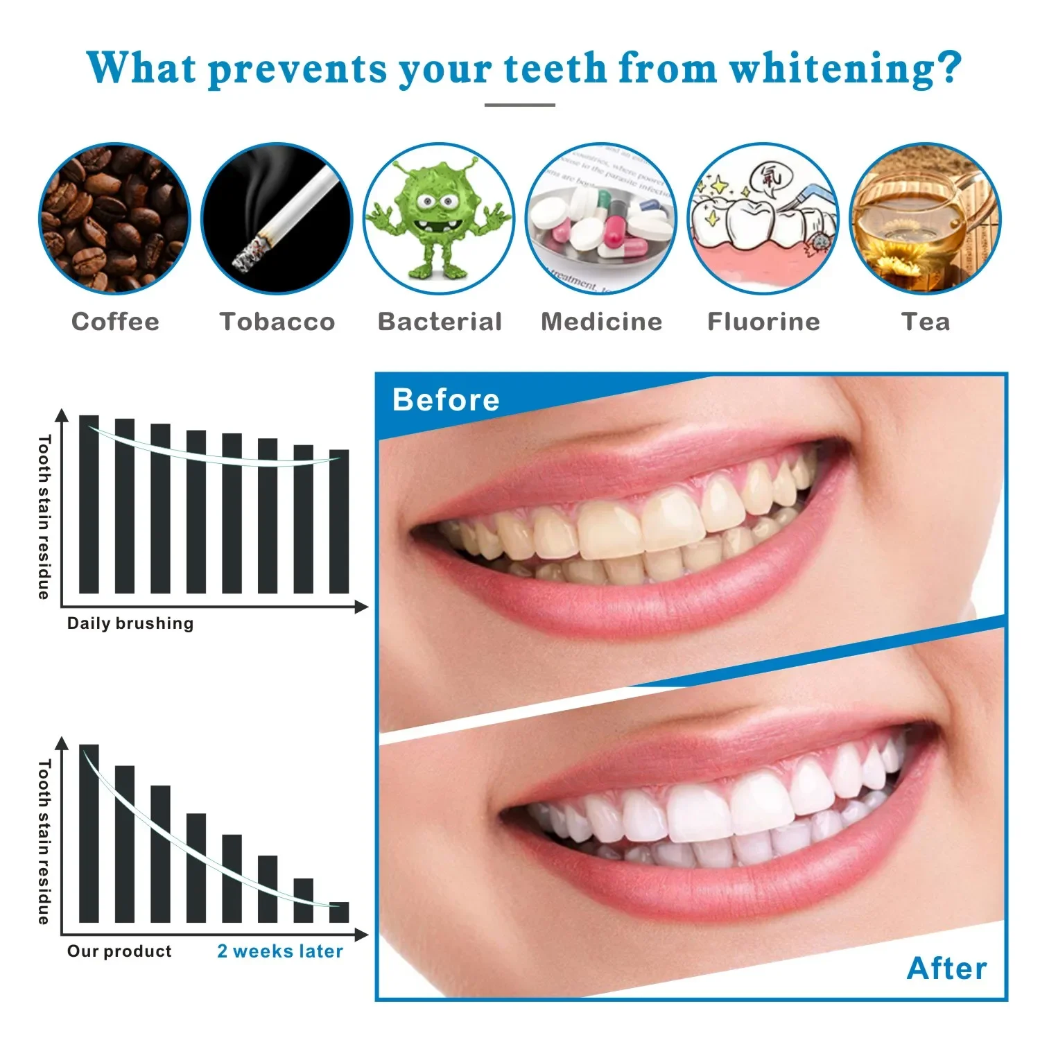 14/28pcs 3D Teeth Whitening St - Teeth Whitening Effects recension och pris